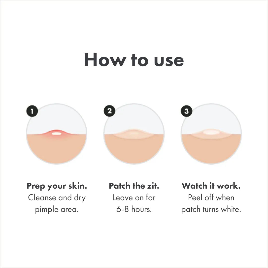 Acne Pimple Patch