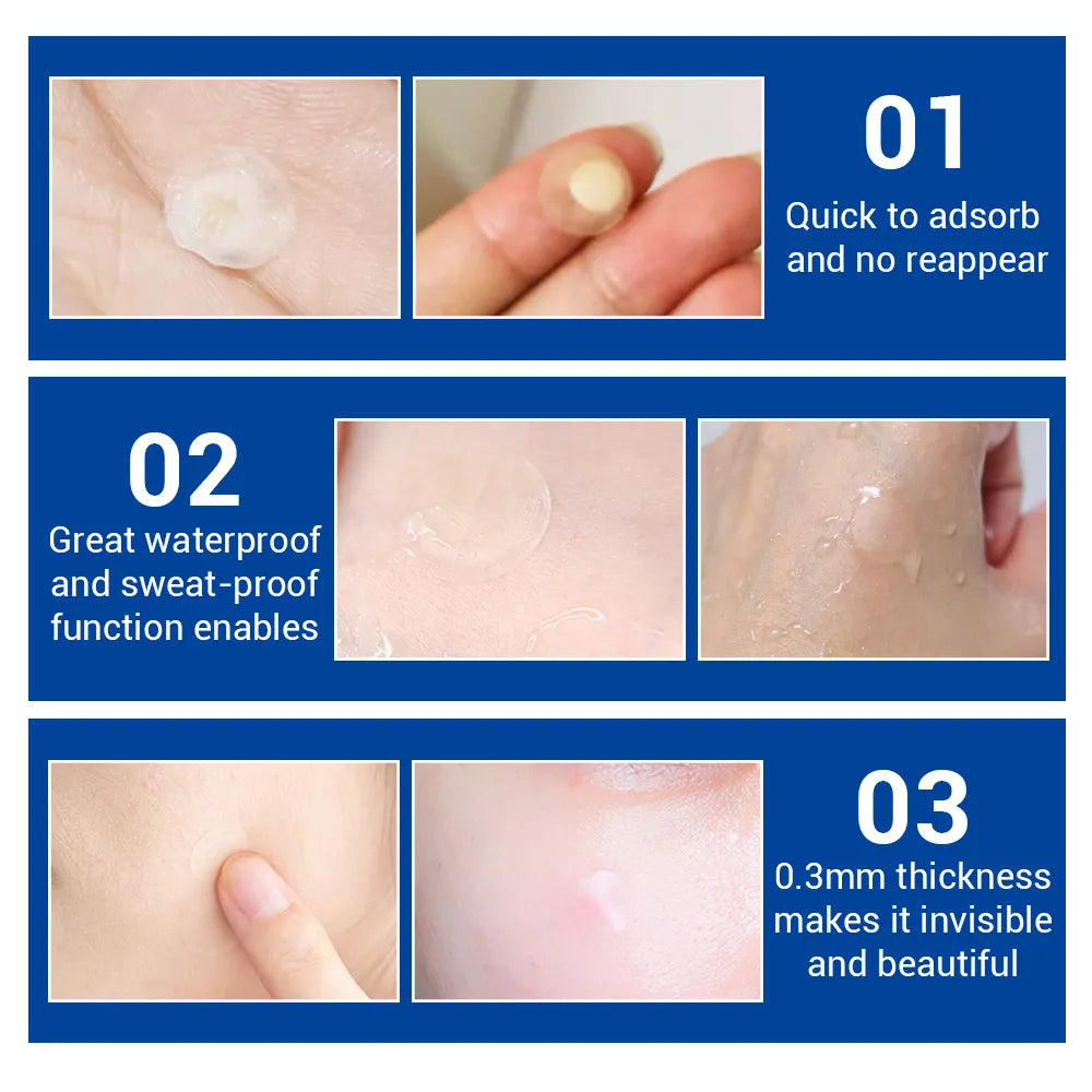 Acne Pimple Patch
