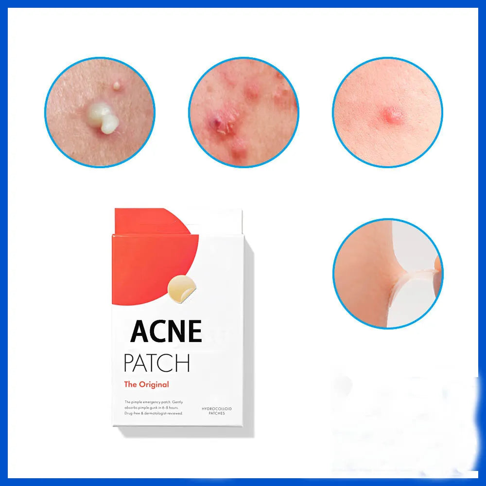 Acne Pimple Patch